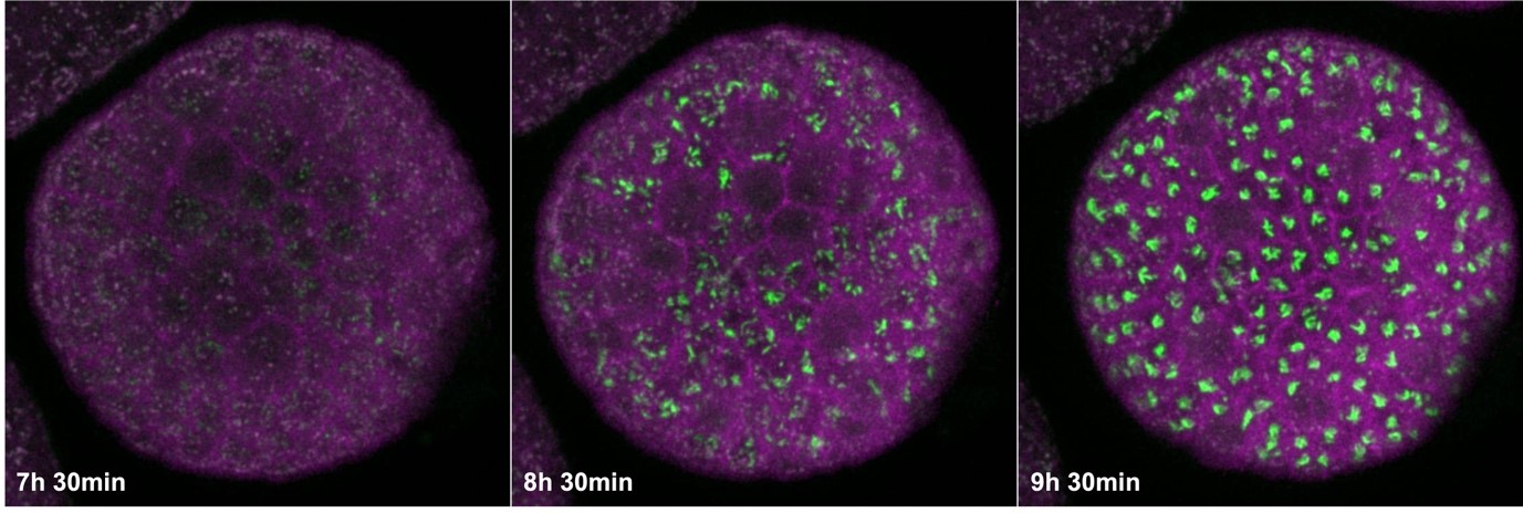 Figura 2 Golgi