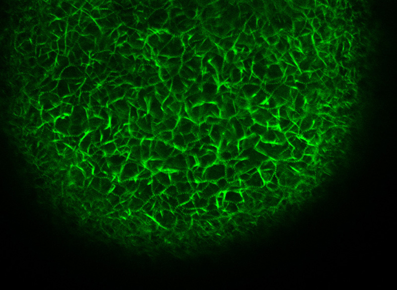 F-actin staining in a starfish oocyte microinjected with Alexa Fluor-568 conjugated phalloidin